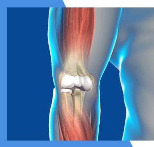Lipogems